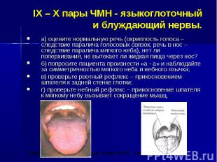 IX – X пары ЧМН - языкоглоточный и блуждающий нервы. а) оцените нормальную речь