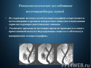 Рентгенологическое исследование желчевыводящих путей Исследование желчных путей