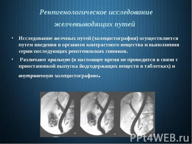 Рентгенологическое исследование желчевыводящих путей Исследование желчных путей (холецистография) осуществляется путем введения в организм контрастного вещества и выполнения серии последующих рентгеновских снимков. Различают оральную (в настоящее вр…