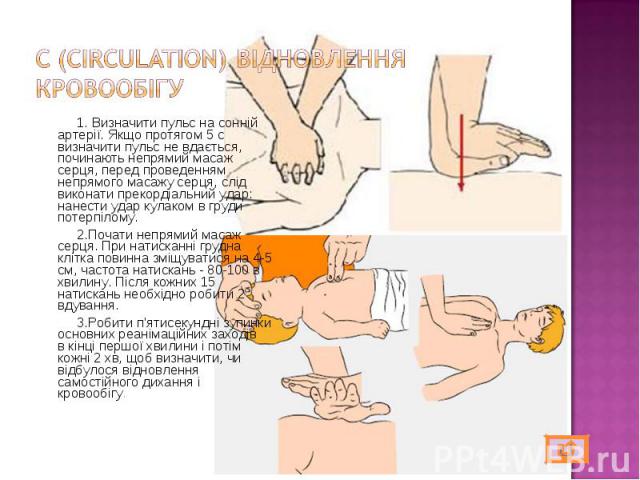 1. Визначити пульс на сонній артерії. Якщо протягом 5 с визначити пульс не вдається, починають непрямий масаж серця, перед проведенням непрямого масажу серця, слід виконати прекордіальний удар: нанести удар кулаком в груди потерпілому. 1. Визначити …