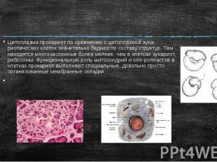 Цитоплазма прокариот по сравнению с цитоплазмой эука-риотических клеток значител