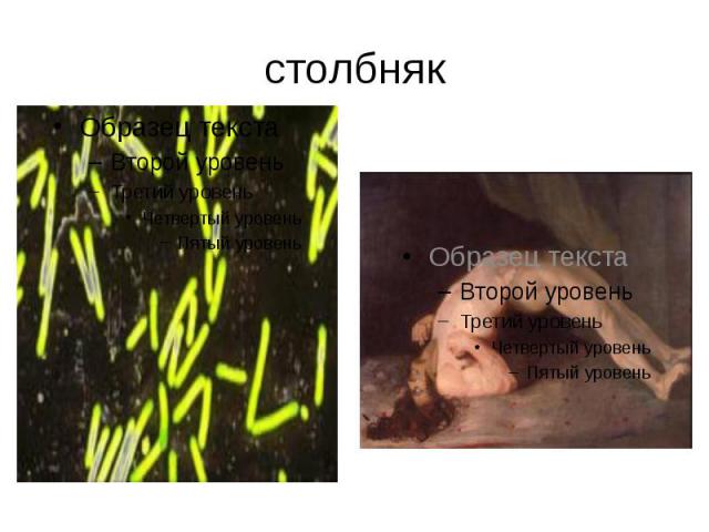 столбняк