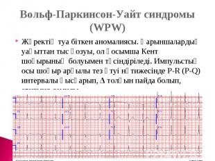 Вольф-Паркинсон-Уайт синдромы (WPW)Жүректің туа біткен аномалиясы. Қарыншалардың