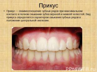 Прикус Прикус — взаимоотношение зубных рядов при максимальном контакте и полном