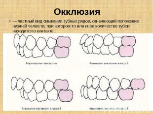 Окклюзия — частный вид смыкания зубных рядов, означающий положение нижней челюст