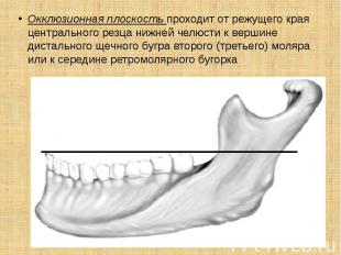 . Окклюзионная плоскость проходит от режущего края центрального резца нижней чел