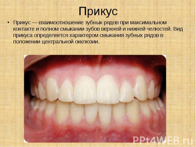Прикус Прикус — взаимоотношение зубных рядов при максимальном контакте и полном смыкании зубов верхней и нижней челюстей. Вид прикуса определяется характером смыкания зубных рядов в положении центральной окклюзии.