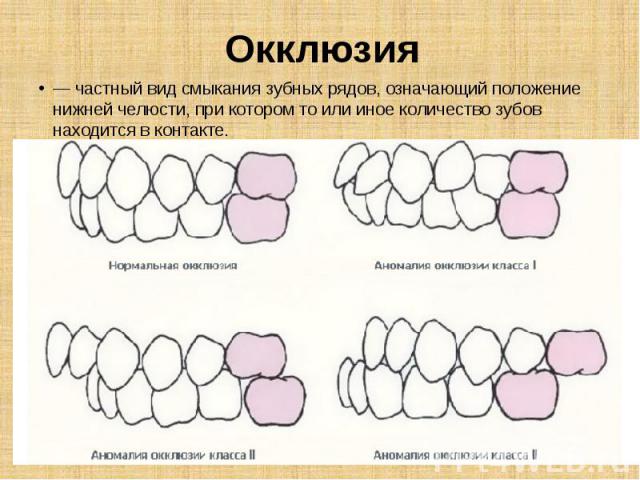 Окклюзия — частный вид смыкания зубных рядов, означающий положение нижней челюсти, при котором то или иное количество зубов находится в контакте.