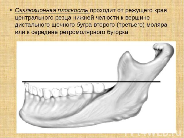 . Окклюзионная плоскость проходит от режущего края центрального резца нижней челюсти к вершине дистального щечного бугра второго (третьего) моляра или к середине ретромолярного бугорка