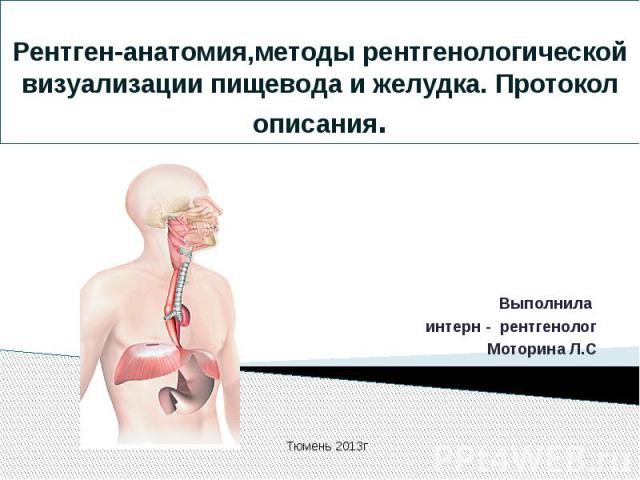 Рентген-анатомия,методы рентгенологической визуализации пищевода и желудка. Протокол описания.Выполнила интерн - рентгенологМоторина Л.С