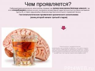 Чем проявляется? Нейроанатомия хронического алкоголизма отражает как прямое токс