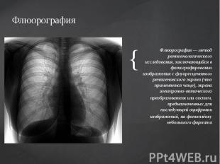 Флюорография Флюорография — метод рентгенологического исследования, заключающийс