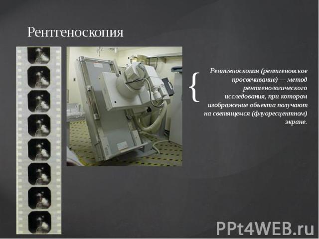 Рентгеноскопия Рентгеноскопия (рентгеновское просвечивание) — метод рентгенологического исследования, при котором изображение объекта получают на светящемся (флуоресцентном) экране.