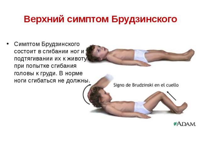 Верхний симптом Брудзинского Симптом Брудзинского состоит в сгибании ног и подтягивании их к животу при попытке сгибания головы к груди. В норме ноги сгибаться не должны.