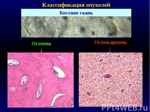Классификация опухолей Костная ткань