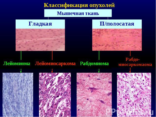 Классификация опухолей Мышечная ткань