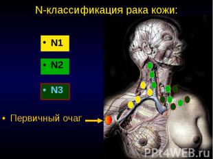 N-классификация рака кожи: N1