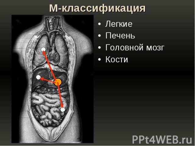 M-классификация Легкие Печень Головной мозг Кости