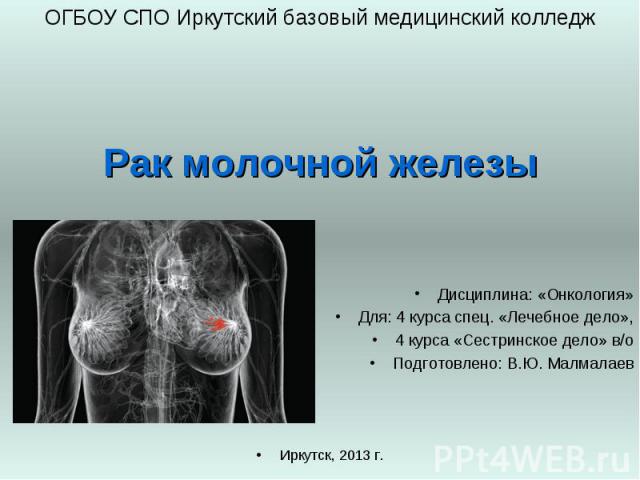 Рак молочной железы ОГБОУ СПО Иркутский базовый медицинский колледж