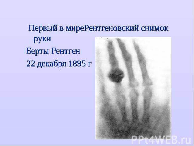 Первый в миреРентгеновский снимок руки Первый в миреРентгеновский снимок руки Берты Рентген 22 декабря 1895 г
