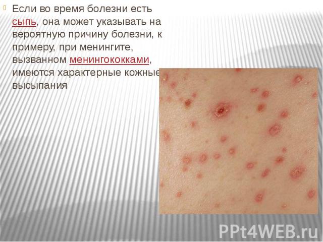 Если во время болезни есть сыпь, она может указывать на вероятную причину болезни, к примеру, при менингите, вызванном менингококками, имеются характерные кожные высыпания