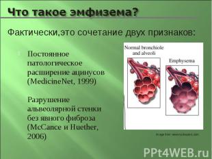 Постоянное патологическое расширение ацинусов(MedicineNet, 1999)Разрушение альве