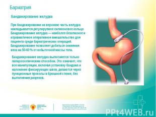 Бариатрия Бандажирование желудкаПри бандажировании на верхнюю часть желудка накл