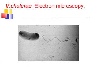 V.cholerae. Electron microscopy.