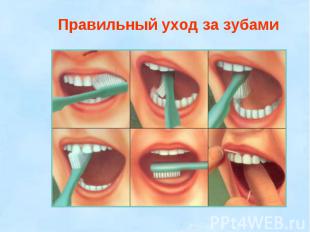 Правильный уход за зубами