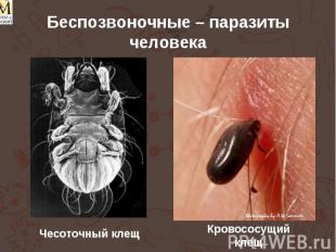 Беспозвоночные – паразиты человека Чесоточный клещ Кровососущий клещ