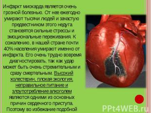 Инфаркт миокарда является очень грозной болезнью. От нее ежегодно умирают тысячи