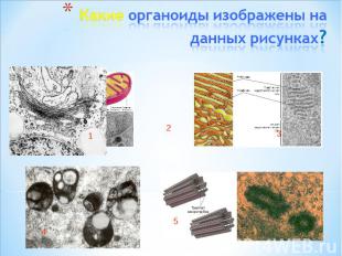 Какие органоиды изображены на данных рисунках?