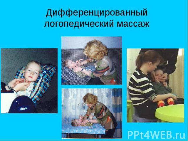 Дифференцированный логопедический массаж