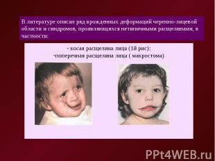 В литературе описан ряд врожденных деформаций черепно-лицевой области и синдромо
