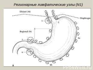 Регионарные лимфатические узлы (N1)