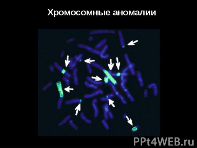 Хромосомные аномалии