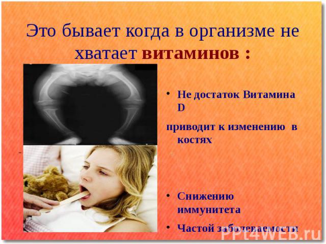 Это бывает когда в организме не хватает витаминов : Не достаток Витамина D приводит к изменению в костях Снижению иммунитета Частой заболеваемости