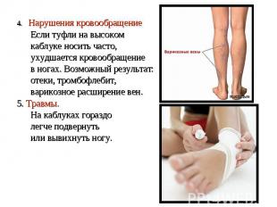 4. Нарушения кровообращение Если туфли на высоком каблуке носить часто, ухудшает