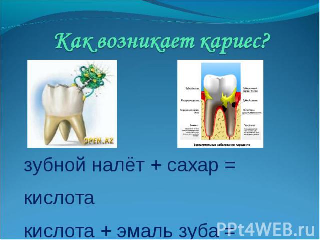 Как возникает кариес? зубной налёт + сахар = кислота кислота + эмаль зуба = кариес