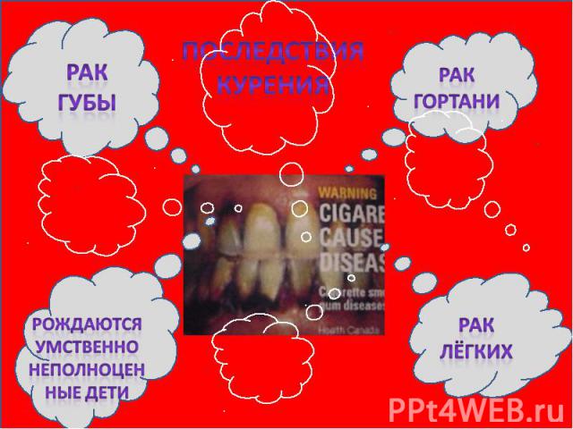 Последствия курения Рак губы Рак гортани Рождаются умственно неполноценные дети Рак лёгких