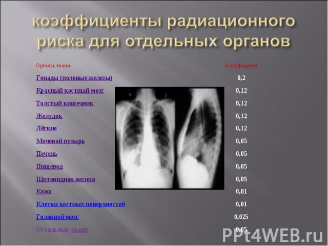 коэффициенты радиационного риска для отдельных органов