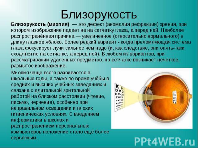 Близорукость Близорукость (миопия) — это дефект (аномалия рефракции) зрения, при котором изображение падает не на сетчатку глаза, а перед ней. Наиболее распространённая причина — увеличенное (относительно нормального) в длину глазное яблоко. Более р…