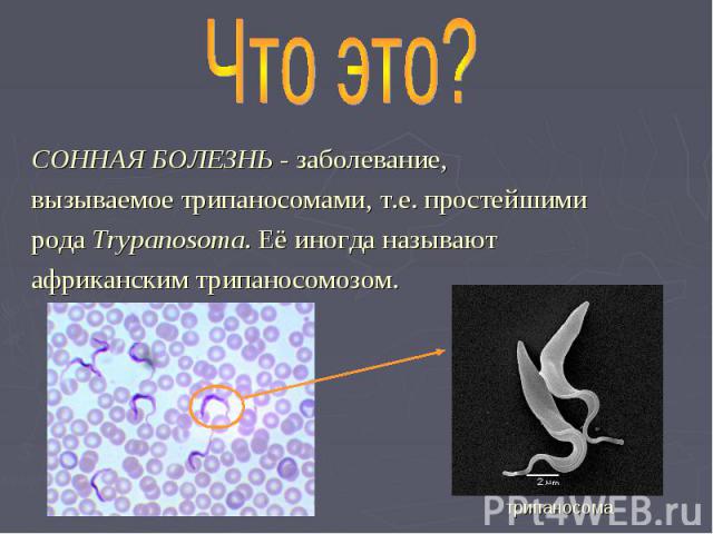 Что это? СОННАЯ БОЛЕЗНЬ - заболевание, вызываемое трипаносомами, т.е. простейшими рода Trypanosoma. Её иногда называют африканским трипаносомозом.