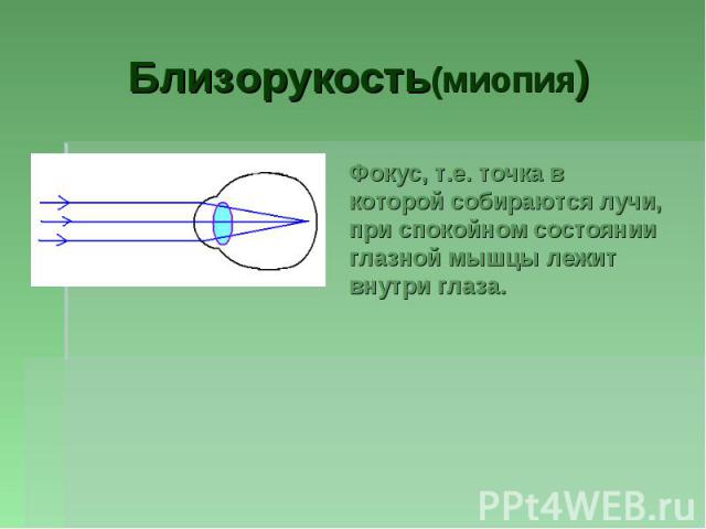 Близорукость(миопия)Фокус, т.е. точка в которой собираются лучи, при спокойном состоянии глазной мышцы лежит внутри глаза.