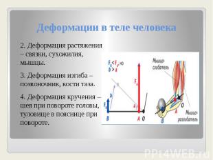 Деформации в теле человека 2. Деформация растяжения – связки, сухожилия, мышцы.3