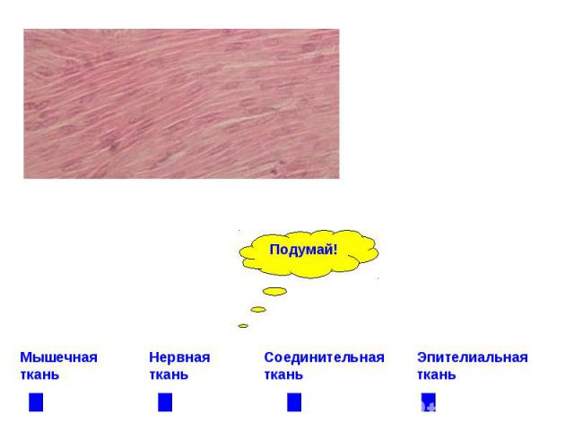 Мышечная ткань Нервная ткань Соединительная ткань Эпителиальная ткань
