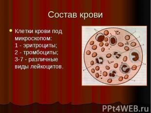 Состав крови Клетки крови под микроскопом: 1 - эритроциты; 2 - тромбоциты; 3-7 -