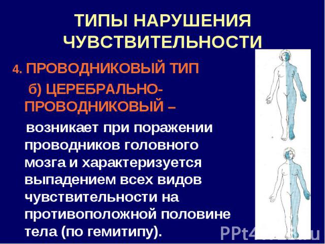 Полиневритический тип расстройства. Нарушение чувствительности по проводниковому типу. Типы нарушения чувствительности. Проводниковый Тип нарушения чувствительности. Проводниковый Тип нарушения всех видов чувствительности это.