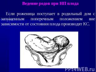 Ведение родов при НП плода Если роженица поступает в родильный дом с запущенным