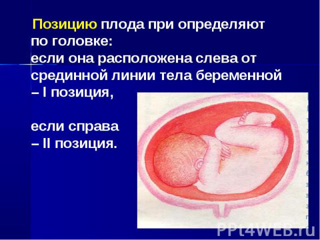 Позицию плода при определяют по головке: если она расположена слева от срединной линии тела беременной – I позиция, если справа – II позиция.